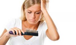 همه آنچه خانم ها باید در مورد ریزش مو هایشان بدانند