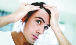 چگونه با استفاده از طب سنتی ریزش مو را درمان کنیم؟