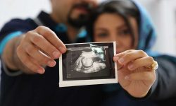 آشنایی با اولین سونوگرافی بعد از بارداری